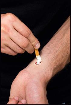 Don Post Cigarette Burn Costume Appliance