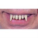 Ghoul Teeth